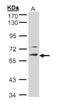 Serine/Threonine Kinase 33 antibody, PA5-28224, Invitrogen Antibodies, Western Blot image 