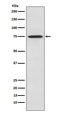 Protein Kinase C Theta antibody, M01293, Boster Biological Technology, Western Blot image 