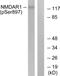 Glutamate Ionotropic Receptor NMDA Type Subunit 1 antibody, PA5-39698, Invitrogen Antibodies, Western Blot image 