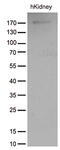 Angiotensin I Converting Enzyme antibody, M00251-1, Boster Biological Technology, Western Blot image 