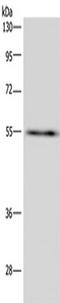 Inosine Monophosphate Dehydrogenase 2 antibody, TA350091, Origene, Western Blot image 