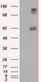 Lipase G, Endothelial Type antibody, CF501033, Origene, Western Blot image 