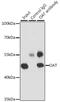 Ornithine Aminotransferase antibody, GTX33373, GeneTex, Immunoprecipitation image 