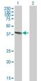 Deoxyribonuclease 2, Lysosomal antibody, H00001777-B01P, Novus Biologicals, Western Blot image 