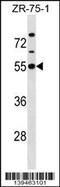 Potassium Voltage-Gated Channel Subfamily J Member 1 antibody, 60-256, ProSci, Western Blot image 