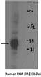Major Histocompatibility Complex, Class II, DR Alpha antibody, ab20181, Abcam, Western Blot image 