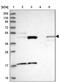 TBC1 Domain Family Member 13 antibody, NBP1-92477, Novus Biologicals, Western Blot image 