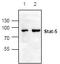 Signal Transducer And Activator Of Transcription 5B antibody, TA318912, Origene, Western Blot image 