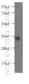 E3 ubiquitin-protein ligase NRDP1 antibody, 17233-1-AP, Proteintech Group, Western Blot image 