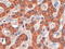 Syndecan Binding Protein 2 antibody, LS-C55552, Lifespan Biosciences, Immunohistochemistry paraffin image 