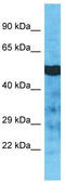 Tubulin alpha-3C/D chain antibody, TA330810, Origene, Western Blot image 