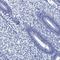 Calcium Binding Tyrosine Phosphorylation Regulated antibody, HPA040703, Atlas Antibodies, Immunohistochemistry paraffin image 