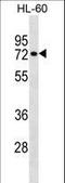 Ras Homolog Family Member T2 antibody, LS-C158849, Lifespan Biosciences, Western Blot image 