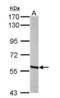 Methylcrotonoyl-CoA Carboxylase 2 antibody, NBP1-33375, Novus Biologicals, Western Blot image 