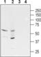 Gamma-Aminobutyric Acid Type A Receptor Rho3 Subunit (Gene/Pseudogene) antibody, PA5-77412, Invitrogen Antibodies, Western Blot image 