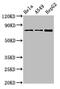 Transglutaminase 2 antibody, CSB-PA11809A0Rb, Cusabio, Western Blot image 