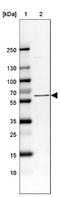 TNF Receptor Associated Factor 7 antibody, NBP1-85068, Novus Biologicals, Western Blot image 