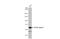 Cholinergic Receptor Nicotinic Alpha 4 Subunit antibody, GTX113653, GeneTex, Western Blot image 