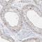 TNFAIP3 Interacting Protein 1 antibody, NBP2-32658, Novus Biologicals, Immunohistochemistry paraffin image 