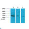 Ciliary Neurotrophic Factor antibody, LS-C813621, Lifespan Biosciences, Western Blot image 