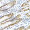 Leucine Rich Pentatricopeptide Repeat Containing antibody, A3365, ABclonal Technology, Immunohistochemistry paraffin image 