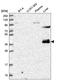 Zinc Finger Protein 385B antibody, HPA046086, Atlas Antibodies, Western Blot image 