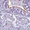 Enkurin, TRPC Channel Interacting Protein antibody, PA5-63969, Invitrogen Antibodies, Immunohistochemistry frozen image 