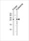 Charged Multivesicular Body Protein 4A antibody, PA5-49410, Invitrogen Antibodies, Western Blot image 