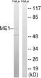 Malic Enzyme 1 antibody, abx014640, Abbexa, Western Blot image 