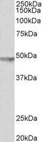 Potassium Voltage-Gated Channel Subfamily J Member 6 antibody, MBS421045, MyBioSource, Western Blot image 