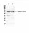 ADAM Metallopeptidase Domain 10 antibody, LS-C662652, Lifespan Biosciences, Western Blot image 