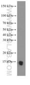 Profilin 2 antibody, 60094-2-Ig, Proteintech Group, Western Blot image 