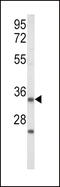 Insulin Like Growth Factor Binding Protein 2 antibody, MBS9209342, MyBioSource, Western Blot image 