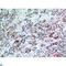 Basic Leucine Zipper ATF-Like Transcription Factor 3 antibody, LS-C813341, Lifespan Biosciences, Immunohistochemistry paraffin image 