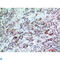 BATF3 antibody, LS-C813341, Lifespan Biosciences, Immunohistochemistry paraffin image 