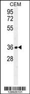 Nudix Hydrolase 22 antibody, 55-755, ProSci, Western Blot image 