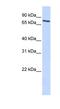 Solute Carrier Organic Anion Transporter Family Member 2B1 antibody, NBP1-59811, Novus Biologicals, Western Blot image 