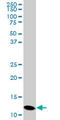 Profilin 2 antibody, LS-C139402, Lifespan Biosciences, Western Blot image 