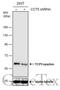 Chaperonin Containing TCP1 Subunit 5 antibody, GTX110167, GeneTex, Western Blot image 