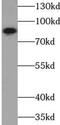 Von Willebrand Factor A Domain Containing 2 antibody, FNab09465, FineTest, Western Blot image 