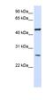 Transmembrane protein 127 antibody, orb325338, Biorbyt, Western Blot image 