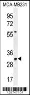 TNF Alpha Induced Protein 8 Like 3 antibody, 56-061, ProSci, Western Blot image 