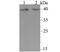 Potassium Two Pore Domain Channel Subfamily K Member 1 antibody, NBP2-76940, Novus Biologicals, Western Blot image 