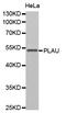 Plasminogen Activator, Urokinase antibody, STJ25020, St John