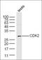 Cyclin Dependent Kinase 2 antibody, orb221358, Biorbyt, Western Blot image 