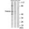 Tripartite Motif Containing 38 antibody, A10133, Boster Biological Technology, Western Blot image 