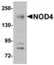 NLR Family CARD Domain Containing 5 antibody, TA320044, Origene, Western Blot image 