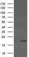 RAB30, Member RAS Oncogene Family antibody, TA505346AM, Origene, Western Blot image 