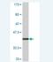 Ring Finger Protein 182 antibody, H00221687-M03, Novus Biologicals, Western Blot image 