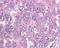 Baculoviral IAP Repeat Containing 5 antibody, NB500-238, Novus Biologicals, Immunohistochemistry paraffin image 